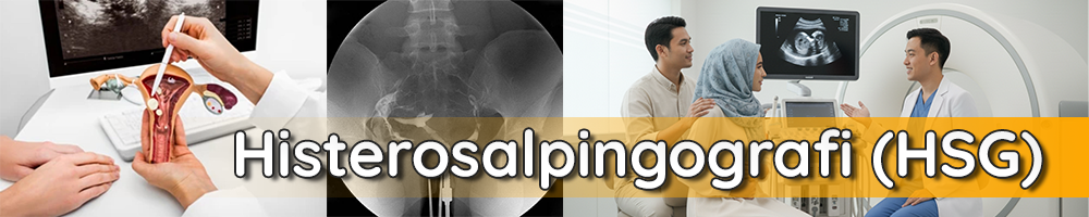 HSG RS DEWI SRI KARAWANG TERBAIK